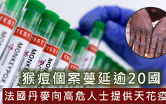 猴痘疫情蔓延逾20國 法國丹麥向高危人士提供天花疫苗