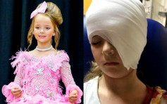 6歲女童遭吊扇割臉縫100針 重拾自信再踏選美舞台