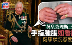 英女皇逝世｜英皇查理斯三世「香肠手」照片疯传 健康状况惹关注