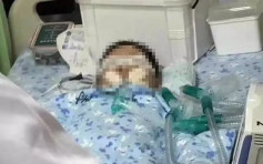 河南5岁男童「陷入脑死」 家属指当局竟要求「拔管」