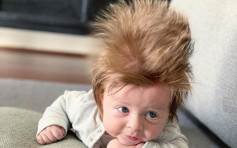 澳洲16周大男嬰髮量驚人  網上爆紅