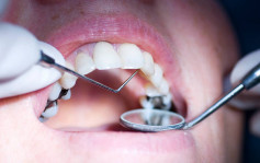 睇一次牙医被补20只牙、杜4只牙根  女子毁容兼全棚牙腐烂告上法庭
