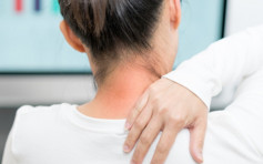 【健康Talk】解析肩膀酸痛成因 日专家推荐3种卧地体操助纾缓