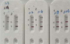 內地研發新試劑 患者15分鐘內可得出結果