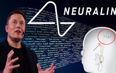 馬斯克旗下大腦晶片公司獲美FDA批准 將展開人體試驗
