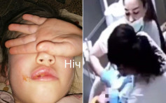 烏克蘭6歲女童睇牙醫後嘴巴異常腫脹 揭醫護虐待多名兒童