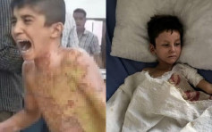 土耳其打叙利亚疑用化武 叙北孩童惨遭白磷灼伤