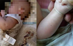 杭州女婴被天降烟灰杯击中 物管排查200户仍未找到肇事者