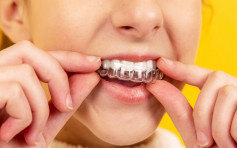 【健康talk】小孩两阶段矫齿治疗大不同 牙医教你分清楚