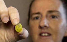 紐西蘭女子鼻腔長期疼痛 塑膠圓片卡進鼻子達37年