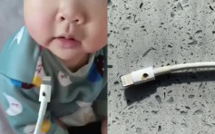 8个月大婴儿充电线塞嘴 母亲取出时冒烟 