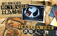 浙江男咳足两年CT有阴影以为肺癌  手术发现竟是「打边炉」害的