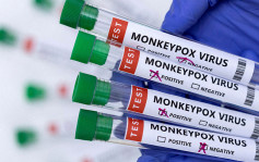 美國CDC：有證據顯示猴痘出現本地傳播 