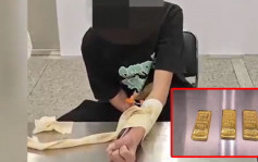 福田入境深圳男子扮「跛手」X光片穿崩  海關揭繃帶藏3公斤黃金︱有片