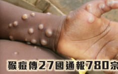 猴痘傳27國通報780宗 世衞維持風險中等