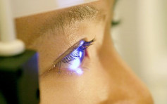 健康talk｜錐形角膜或永久損害視力 激光打磨角膜術精準處理更低風險