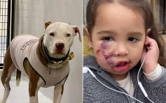 3歲女童被狗咬傷狗主不顧而去 送院後縫15針日後需整形 