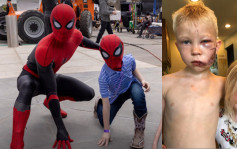 美国男童为救妹惨被恶犬咬伤脸 事隔一年获邀与蜘蛛侠同游片场