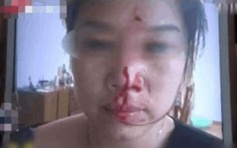 江西女辱罵送餐員 被打至頭破血流