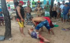 巴西男淺水區遭鯊魚攻擊　右腿被撕咬血肉模糊要截肢