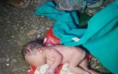 【重男轻女】印度女婴被弃垃圾箱 救起全身沾满蚁
