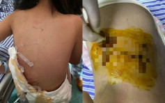 江西8歲女童遭洛威拿犬咬至重傷 當場昏迷
