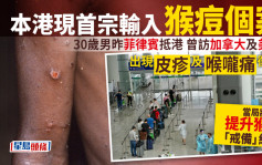 猴痘｜香港现首宗猴痘输入个案 菲律宾抵港30岁男子曾进行高危活动