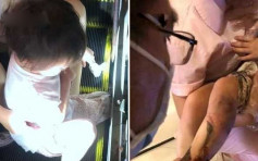 深圳4岁女童小腿被卷入扶手电梯缝隙 消防员花1小时救出