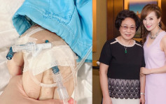羅霖83歲母親不敵癌魔病逝 羅母曾切一半肝保命去年癌細胞擴散