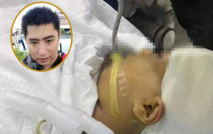 湖南男教师擸三角尺狂扑 9岁女生头爆流脑浆开颅5小时抢救