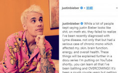 经历4年低潮期 Justin Bieber自爆患不治之症