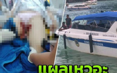 中国女游客PP岛快艇船尾跳水 被船桨割伤双脚