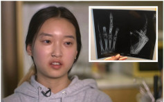 韩女赴澳洲工作假期 半数手指惨遭截断音乐梦碎