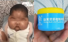 5个月大女婴搽含激素面霜后变大头娃娃 当局下令回收停产及下架