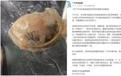 廣州官方通報職校食堂飯菜發現異物　「高度可能為鴨眼球鞏膜」