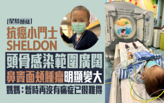 癌细胞扩散｜Sheldon鼻窦面颊肿瘤明显变大 妈妈：暂再没痛症已很难得