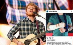 Ed Sheeran踩單車傷手 亞洲巡演或受影響