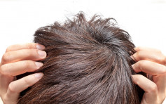 【健康talk】預防脫髮從洗髮吹頭做起 醫生拆解潔護頭髮迷思