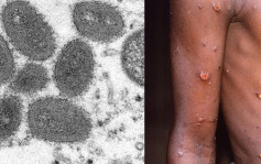 中疾控：10月新增127宗猴痘确诊病例