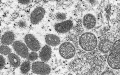 台完成首宗猴痘个案基因排序 病毒株属欧美流行类型 