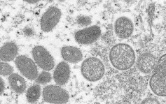 再多8国出现首宗个案 专家 : 猴痘变异速度比预期快12倍