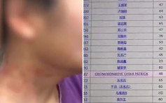 非籍确诊男咬伤广州护士 一年后疑似死亡尸体无人认领