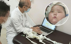6歲患癌女兒成植物人卧床16個月 慈父獲仁醫跟進病情