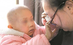 3歲女童患惡瘤致右眼失明 不忍母傷心稱「看得見媽媽」