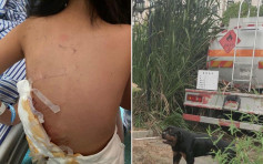 江西8岁女童遭禁养犬咬伤 昏迷住院23天