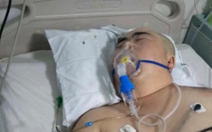內蒙古男子墜樓梯昏迷 憑8個月大兒子哭聲喚醒
