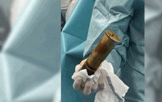 88歲翁肛門塞一戰未爆彈  醫院急召拆彈專家支援  醫護：從未遇過！