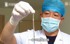 29顆磁力珠塞入尿道 西安男忍痛10天始求醫取出