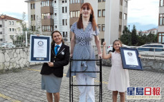 土国女子基因失调 身高逾2.15米膺全球最高女性