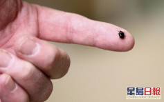 日本发现蜱虫携带新病毒 可传染人类致39度高烧